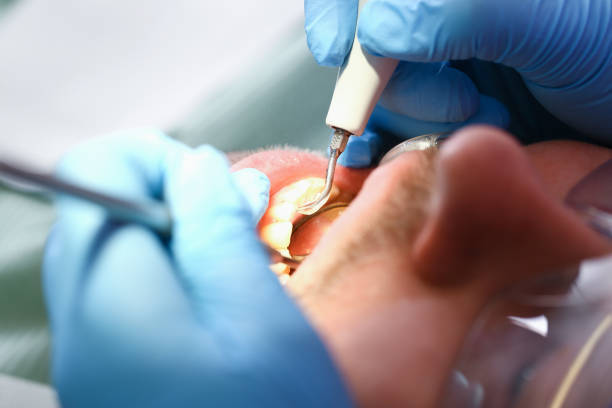 Best Weekend Emergency Dentist in Pardeeville, WI