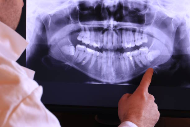 Best Emergency Root Canal Treatment in Pardeeville, WI