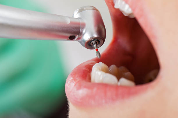 Best Emergency Wisdom Teeth Removal in Pardeeville, WI